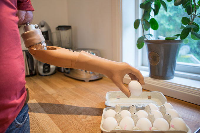 A person with a bionic arm prosthesis picks up an egg from a carton on a kitchen counter